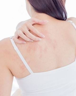 Webinar: Atopični dermatitis in nega atopične kože